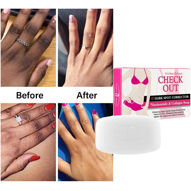 

Отбеливающее мыло ручной работы для шеи, подмышек, коленей, локтей, тела, увлажнение, контроль жирности, питание тела, забота о здоровье