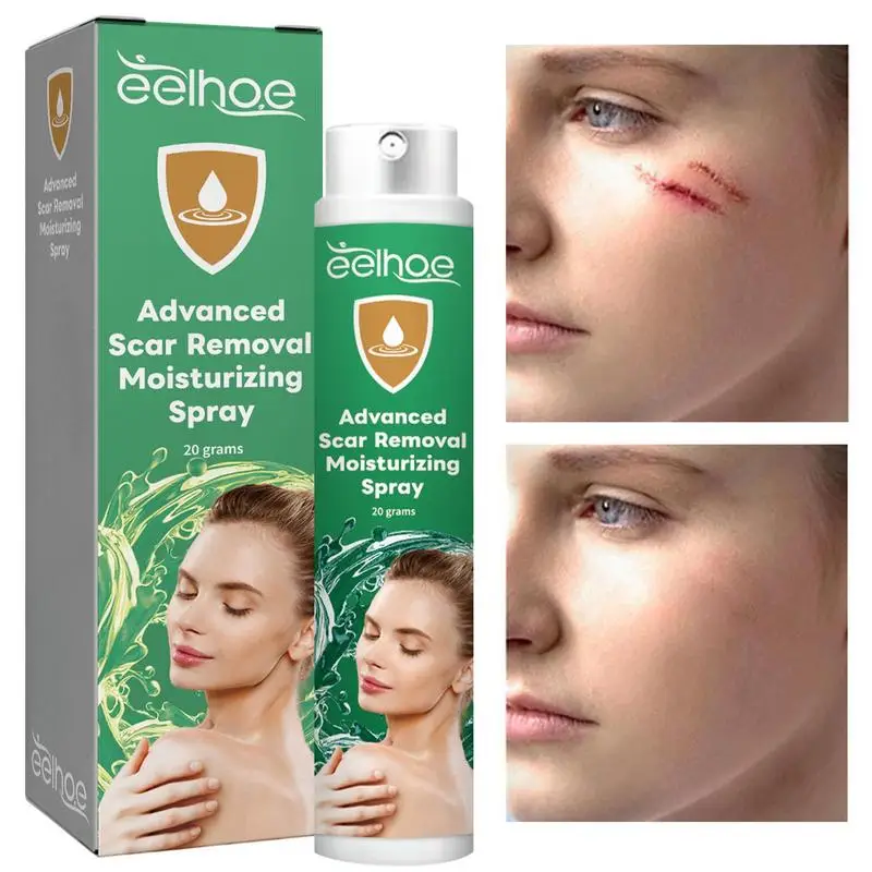 

20g Medical Grade Scar Removal Spray Scar Remove Advanced Scar Spray for Face Dark Spots Remover Gentle Skin Care