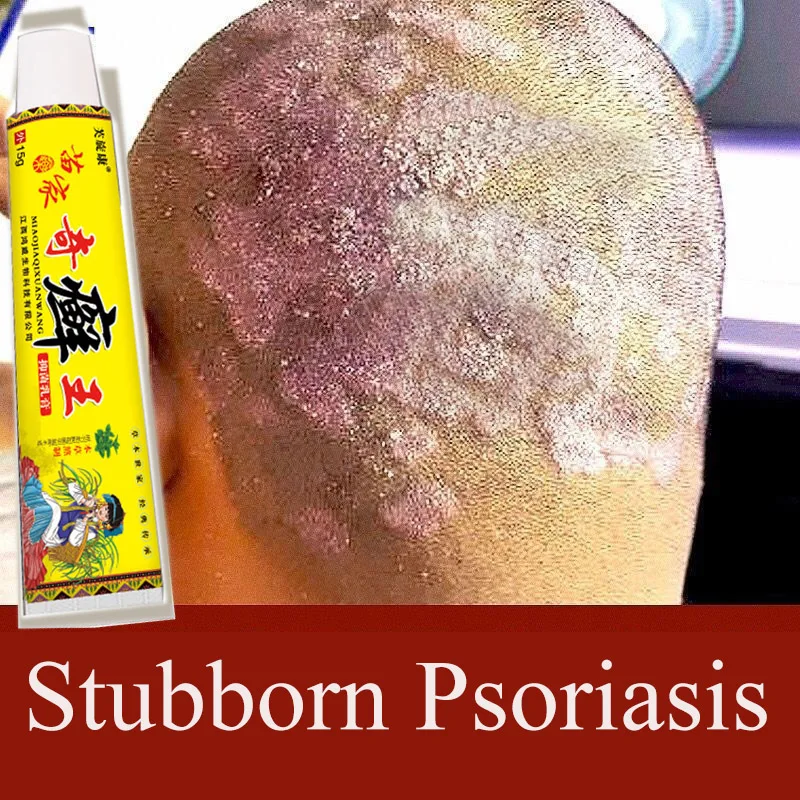 

15g Psoriasis Dermatitis Eczematoid Eczema Ointment Relief Anti-Itch Chinese Herb Medical Skin Care Cream Effective