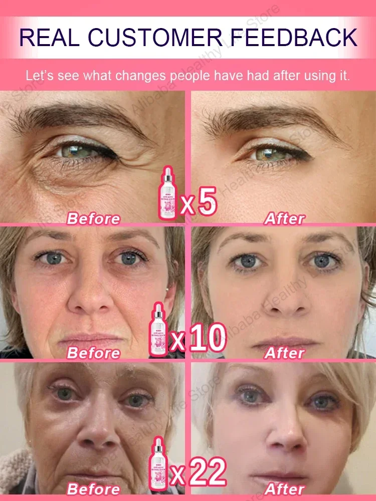 Завершите возрастное беспокойство! Сделайте себя уверенно! Будьте еще 20!