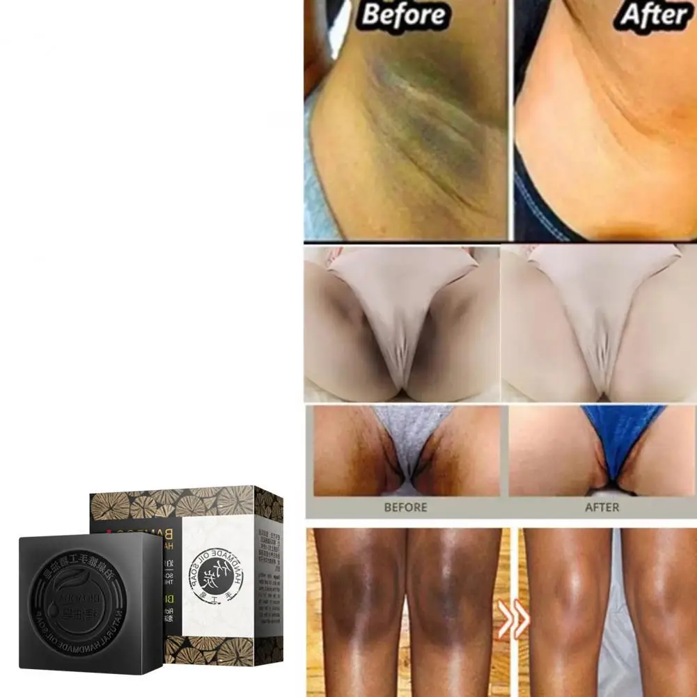 

100g Body Whitening Soap Practical Body Dryness Prevent Whitening Handmade Soap Fragrant Oil Control Skin Whitening Soap
