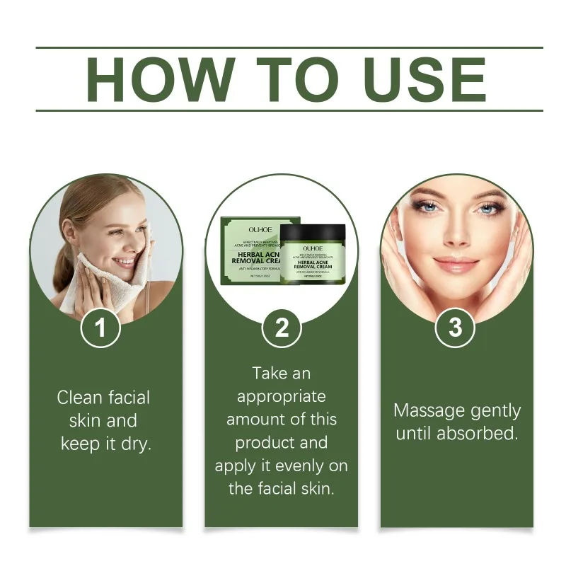 Травяной крем для лица удаления прыщей удаление следов от контроль жирности