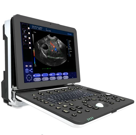 laptop portable animals ultrasound/ Veterinary Ultrasound Machine/Vet Handheld Ultrasound Scanner mindray ultrasound machine