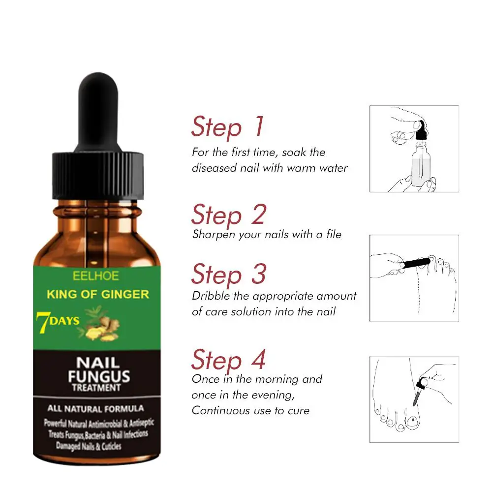 

Ginger Nail Repair Liquid Nails Solution Fungal Nail Antifungal Anti Fungus Toe Nail Care Hand And Foot Onychomycosis Care