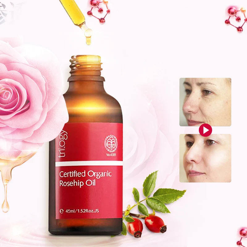 

100% Original NewZealand Trilogy Certified Organic Rosehip Oil for Scar Fine Lines Wrinkle Stretch Marks Dehydrated Ageing Skin