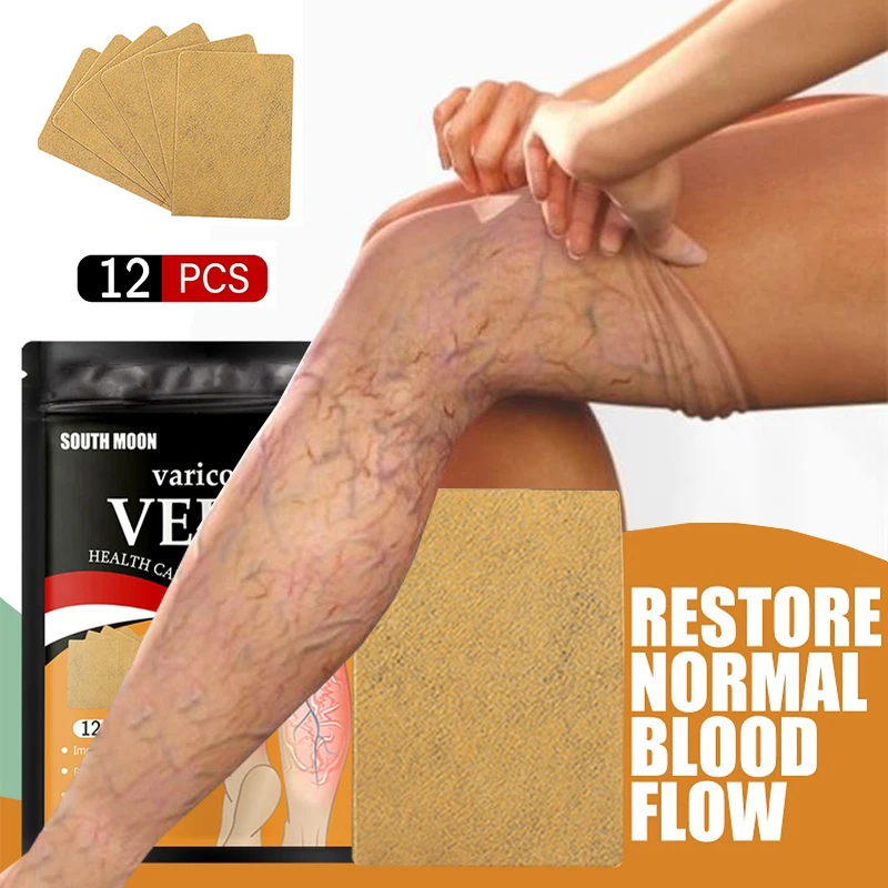 

12/24pcs Varicose Vein Treatment for Legs Leg Sore Swelling Relief Plaster Earthworm Vasculitis Phlebitis Spider Patch Stickers