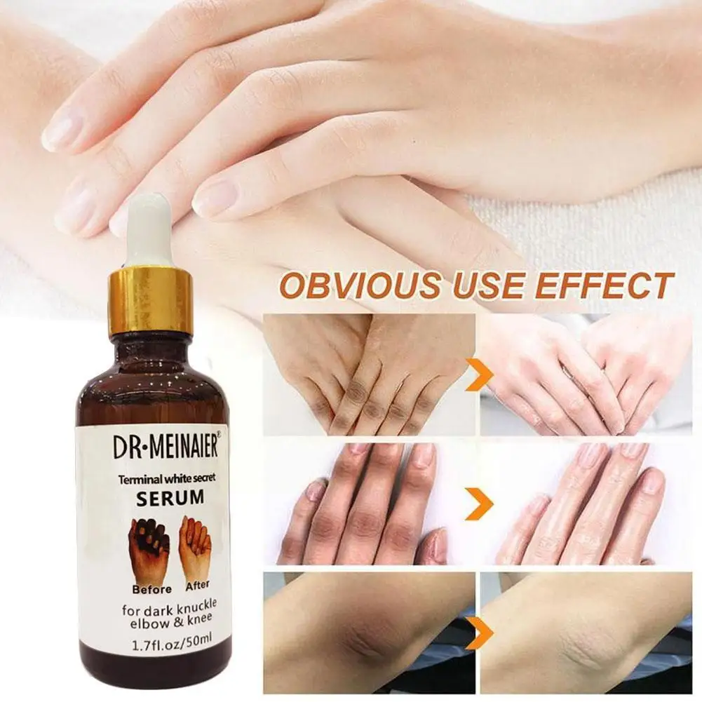 

Светящаяся Сыворотка для суставов рук, 50 цветов, сыворотка для удаления суставов коленей и коленей, сыворотка для суставов в темноте A7S8