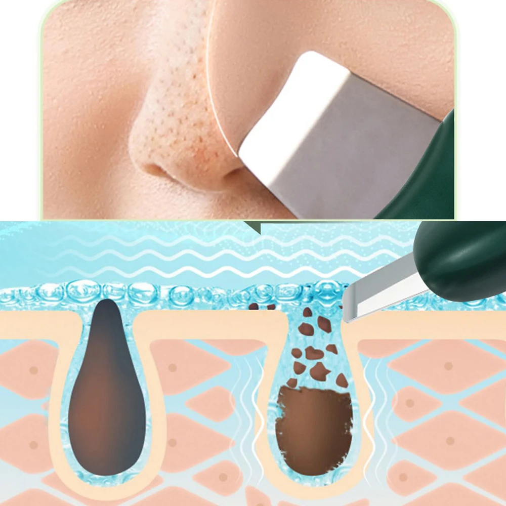 Портативная лопатка для угрей мини-устройство красоты ручная очищения лица