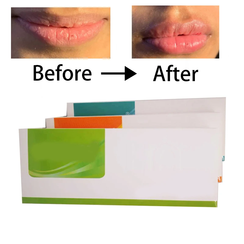 

Cross-linked HA Lip Hyaluronic Acid Pen Lip Face Nose For Hylauron Pen With Box 1ml /2ml /5ml/10ml/20ml