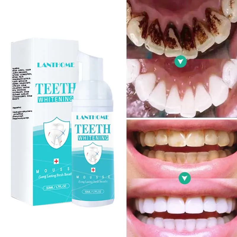 

Lasting Teeth Cleansing Whitening Mousse Removes Stains Tartar Teeth Whitening Oral Hygiene Mousse Toothpaste Fresh Bad Breath