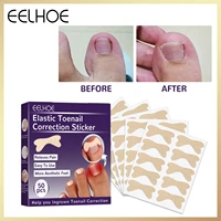 eelhoe 50pcs nail art ingrown correction sticker waterproof fixer paronychia recover ingrown toenail corrector strips pedicure