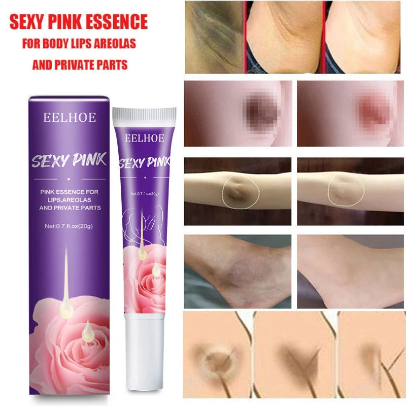

Body Whitening Cream For Dark Skin Intimate Area Pink Essence Dullness Brighten Skin Whitener Beauty Health For Dropshipping 20g