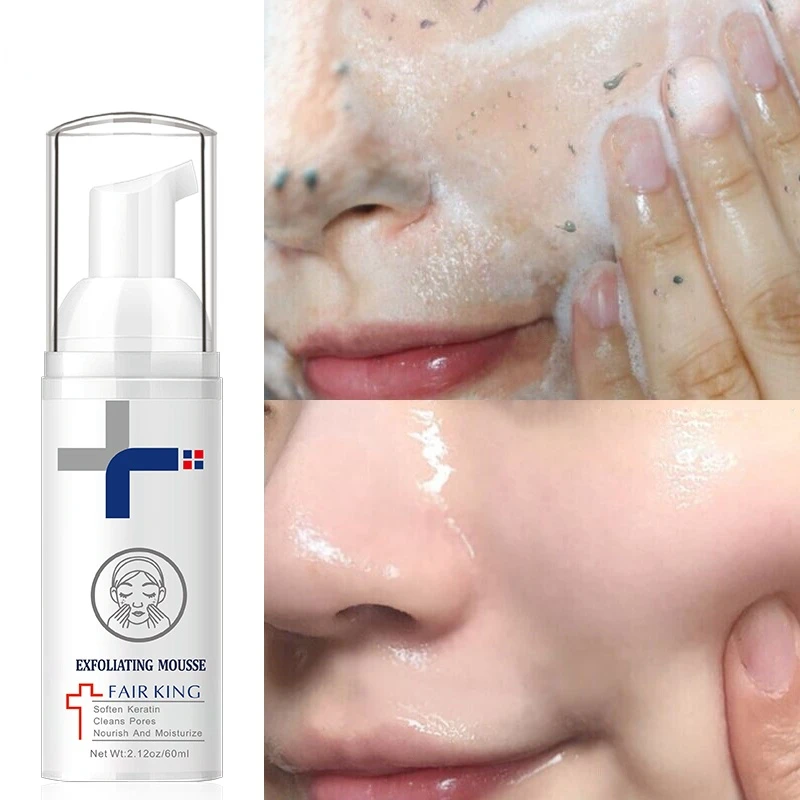 

Skin Exfoliator Cream Facial Exfoliating Mousse Peeling Gel Face Scrub Deep Remove Cleaning Smooth Moisturizing Facial Cleanser