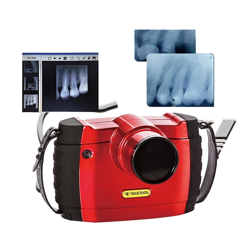 

Digital Portable X-Ray Unit Imaging System Handheld XRay Machine Camera