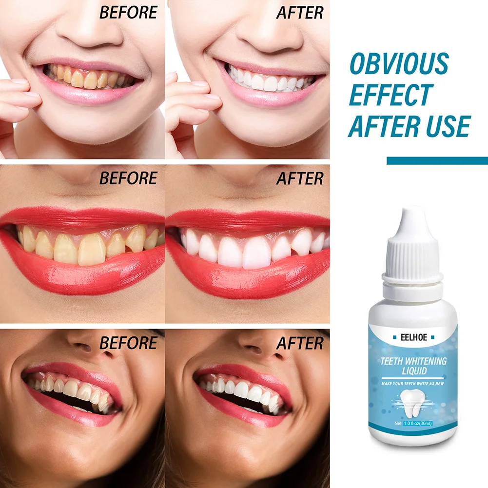 

Teeth Whitening Essence Oral Cleaning Serum Remove Tooth Stains Plaque Reduce Bad Breath Teeth Whitening Oral Care