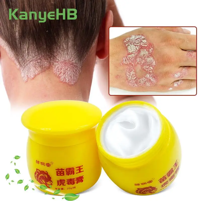 

2Pcs Psoriasis Cream Eczema Treatment Ointment Herbal Extract Antibacterial Anti Itching Effective Eliminate Dermatitis A1618