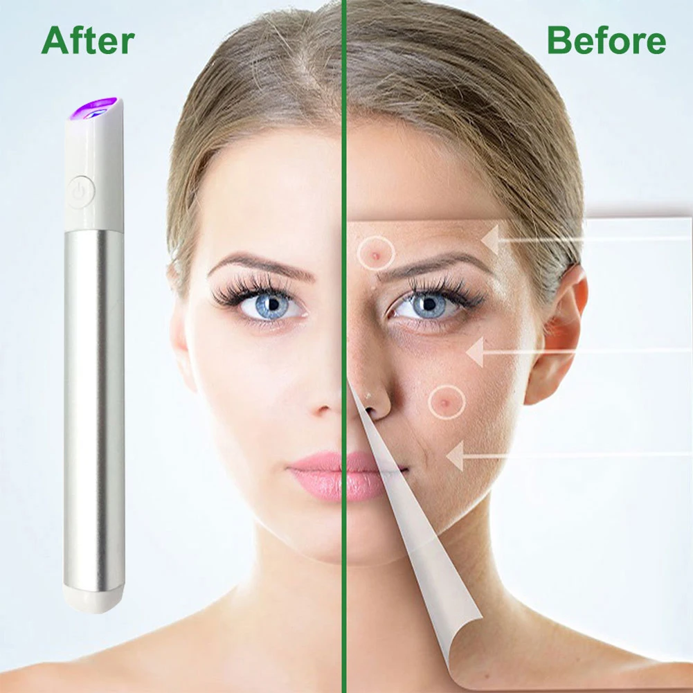 

Blue Light Therapy Acne Laser Pen Skin Spots Wrinkle Removal Pen Heated Spots Tattoo Scar Mole Freckle Pimple Removal Device