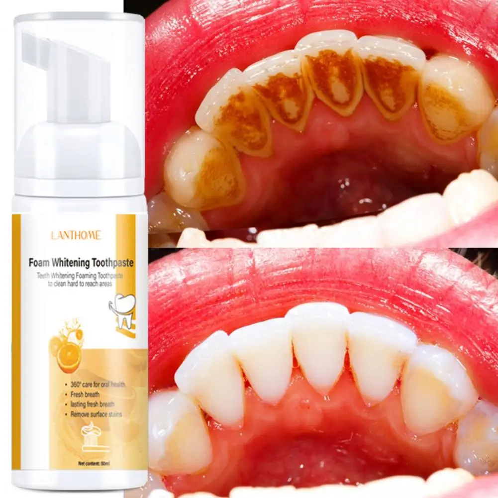 

Mousse Toothpaste Practical Clean Tooth Stains Effective Fruit Mouth Freshener Cleaning Toothpaste Household Supply