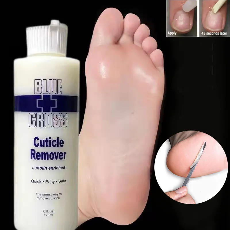 

Blue Cross Foot Softener Removes Dead Skin From Nails Gentle Exfoliation Softens Foot Calluses Repairs Cracked Heels