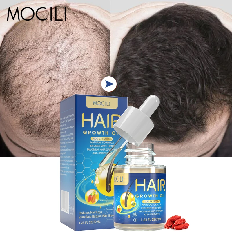 

Hair Growth Oil Prevent Baldness Scalp Treatment Anti Hair Loss Improve Thinning Nourish Repair Dry Damaged Hair Care 32ml