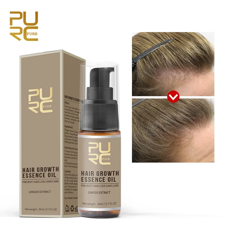 

Имбирное масло для роста волос PURC, предотвращает выпадение волос, стимулирует рост волосяного фолликула, кровообращение, регенерацию волос, эфирное масло