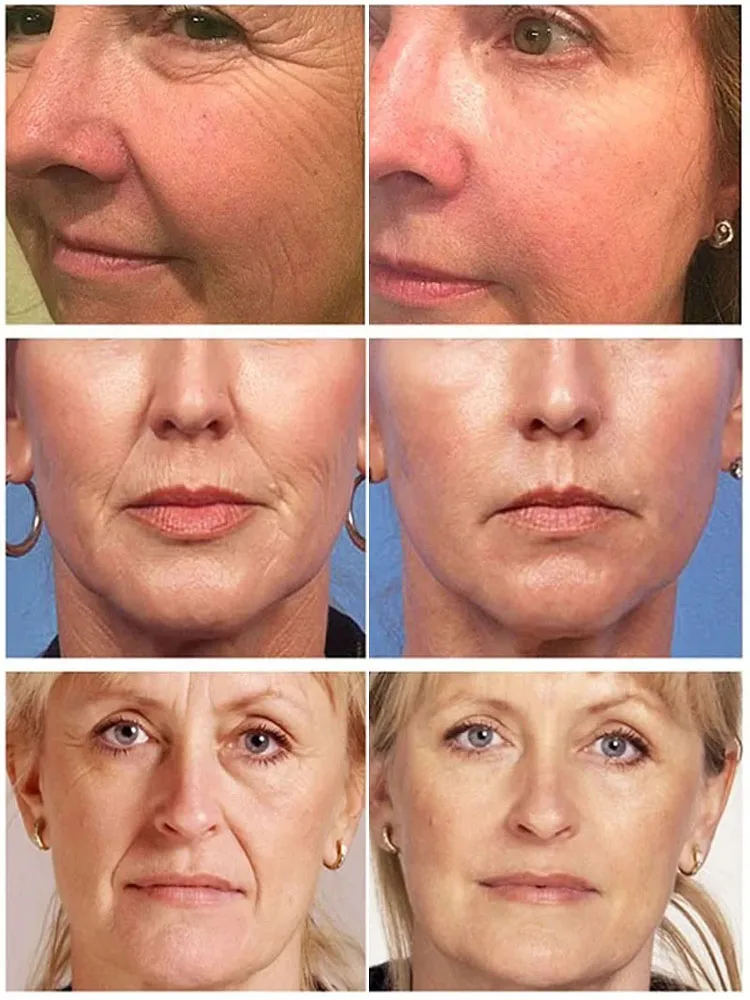 Антивозрастная лифтинг-укрепляющая сыворотка для лица с ретинолом средство