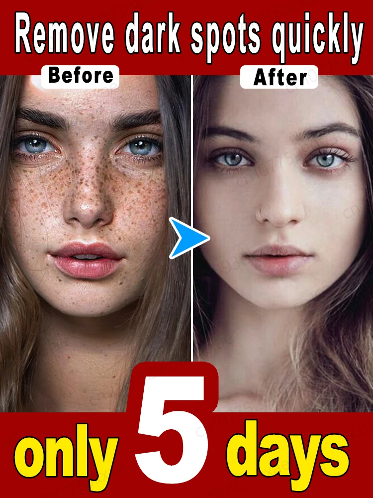 Средство для удаления темных точек на лице