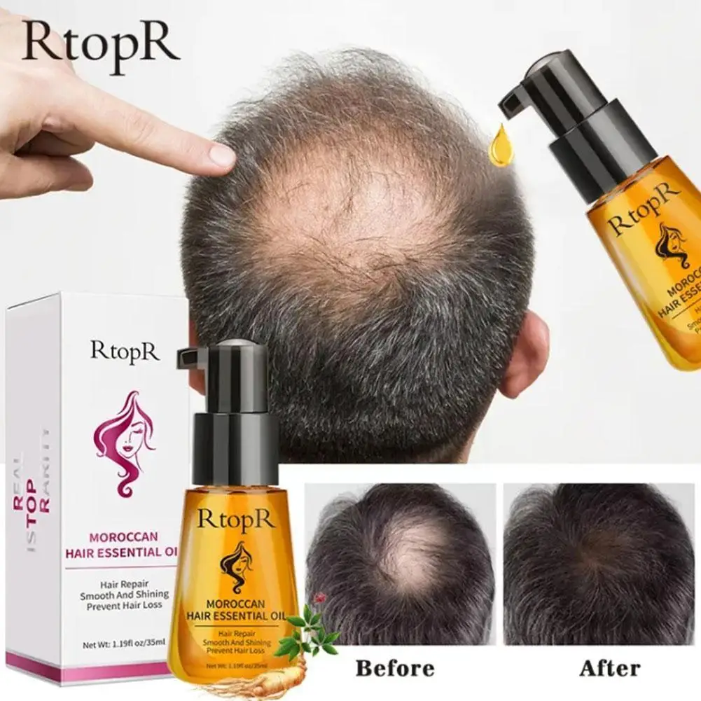 

New Oil For Black Women Serum Hair Grower Spray Anti Hair Fall Hair Loss Treatment Essence Oil For B6V6