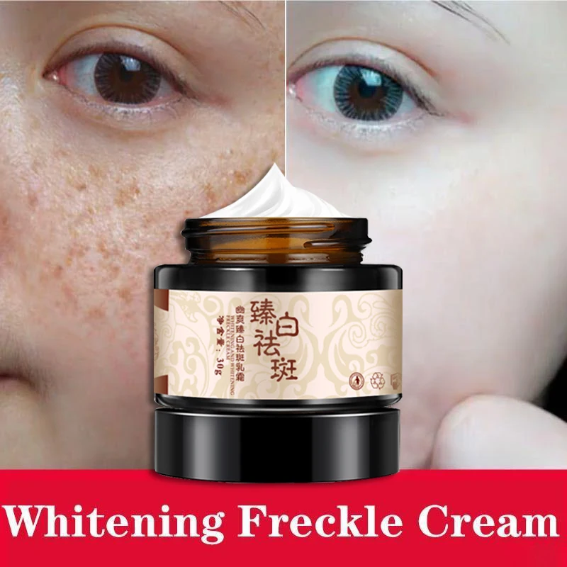 

Whitening Freckle Cream Melasma Remover Dark Spots Remove Lightening Blemish Removal Serum Anti-Aging Moisturize Brighten Cream