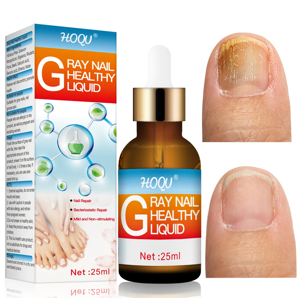

HOQU 7Days Nail Fungus Treatment Feet Care Essence Extra Strong Nails Repair Foot Toe Nail Fungal Removal Gel Beauty Health
