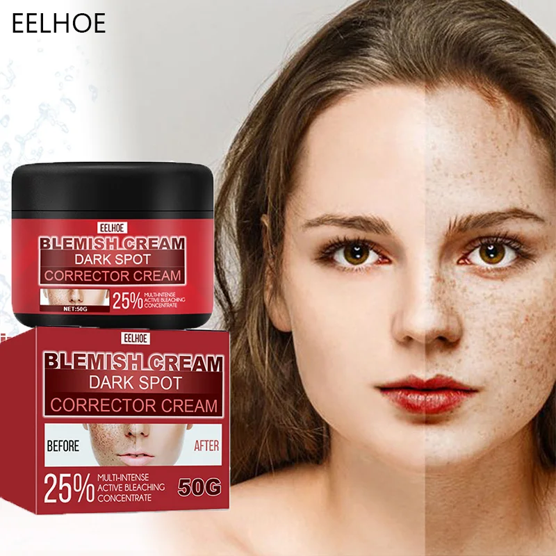 Effective Whitening Freckles Cream Fade Dark Spots Remove Melasma Pigmentation Brighten Skin Care Anti-Aging Moisturizing Beauty