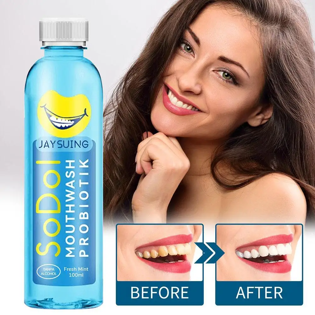 

100ml Portable Relieve Toothache Concentrated Mouth Wash Hygiene Cleaning Mouthwash Remove Stains Odor Bad Breath