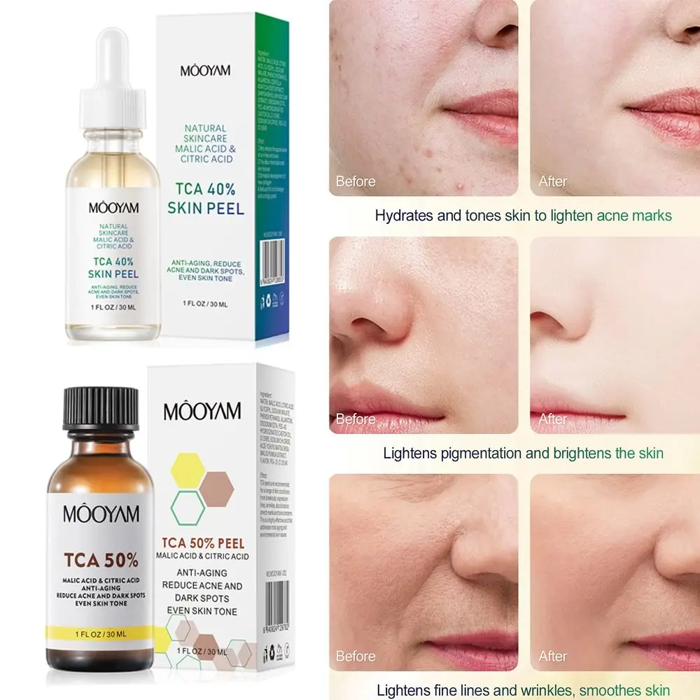 Пилинг молочный кислотой. Glow peel мультикислотный пилинг. Пилинг 40. Жидкость mr. Биодерма себиум найт пил.