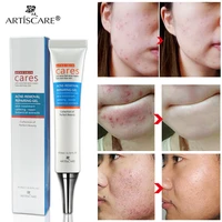 effective acne removal cream tea tree acne spots oil control acne cream skin care whitening moisturizing face gel skin care 20g