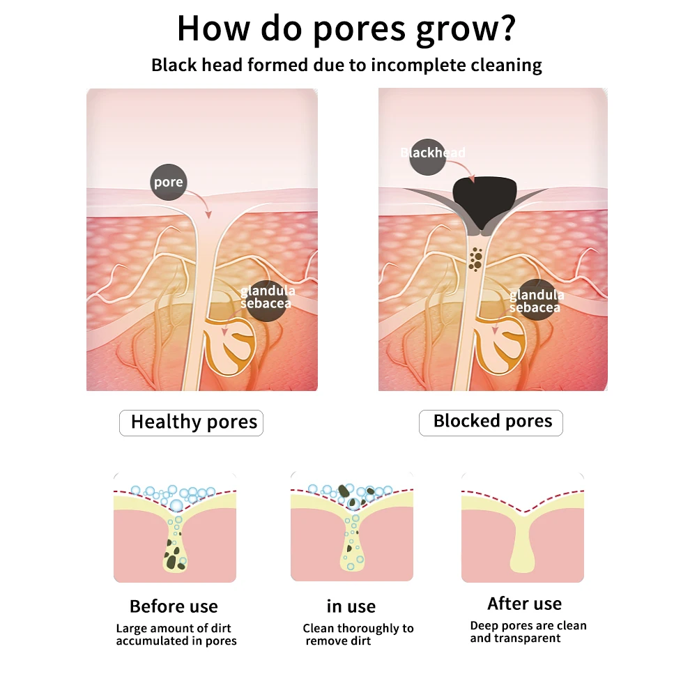 Средство для удаления черных точек маска лица глубокое очищение снятие ухода за