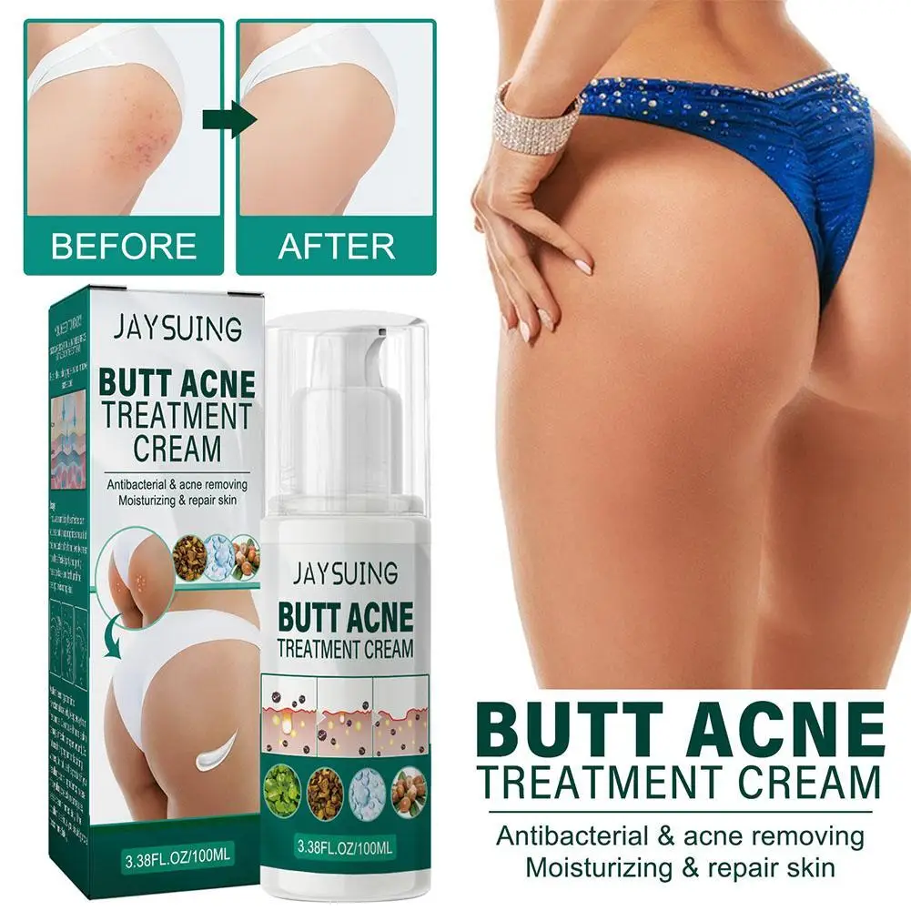 

100ml Butt Acne Clearing Lotion Thigh Buttocks Acne Treatment Cream Reduce Pimples Hips Smoothing Scars And Dark Spot Remover