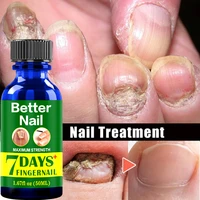 7days fungal nail repair serum care treatment foot nail fungus removal gel anti paronychia onychomycosis