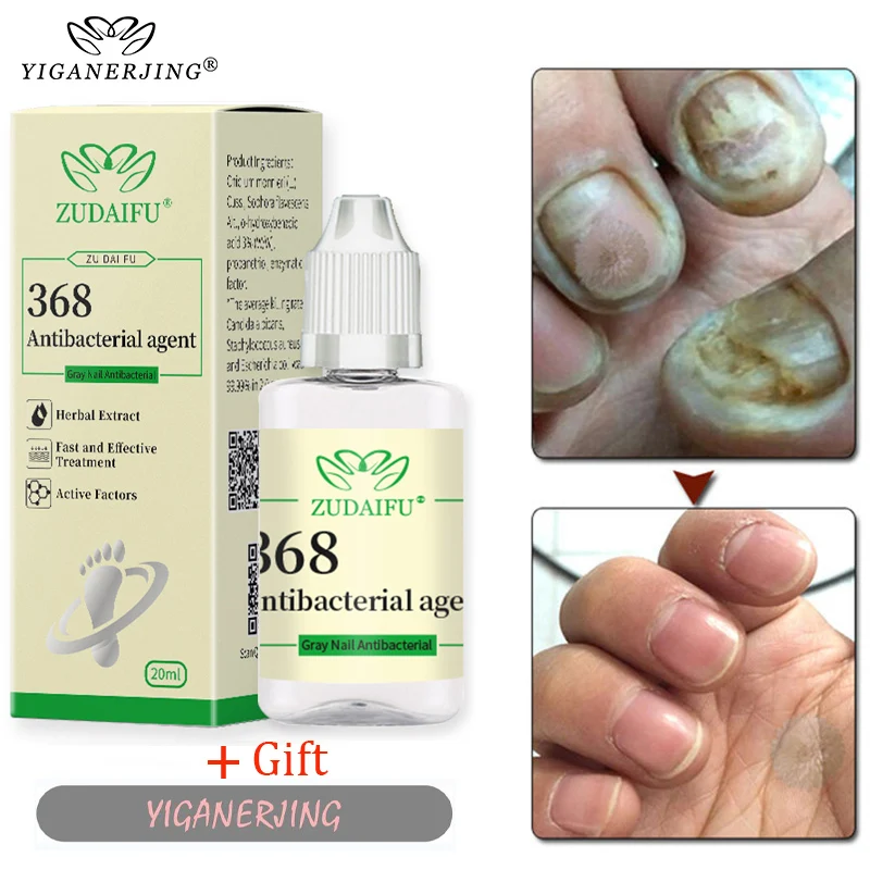 

ZUDAIFU 368 Antibacterial Agent Nail Fungal Feet Care Essence Foot Toe Nails Repair Anti Infection Paronychia Onychomycosis Care
