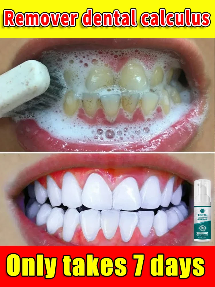 Резолирующий много Los Балка стоматологов