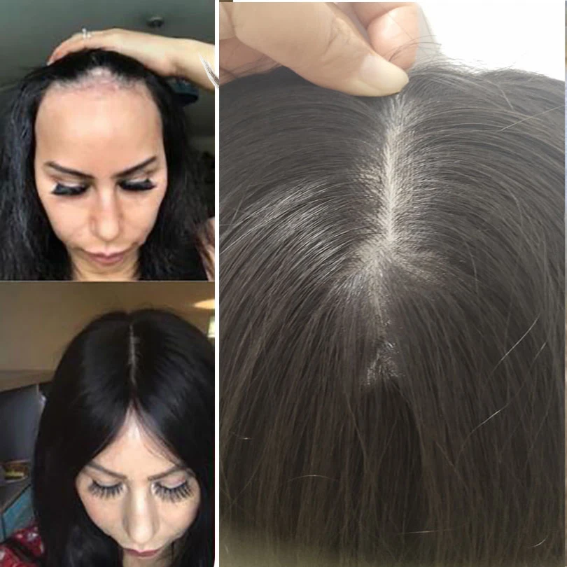 

20 inch Remy Human Hair Silk Base Top Hairpiece for Women Clip in Crown Topper Hairpiece 120 Density with Thining Hair Loss Hair