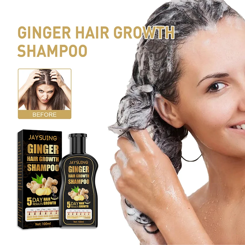 Ginger shampoo prevent hair loss remove dandruff compact hair moisturize smooth fluffy Anti-Hair Loss Shampoo Free shipping