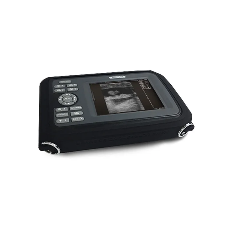 

CE Approved handheld ultrasonido Scanner (palm Size )