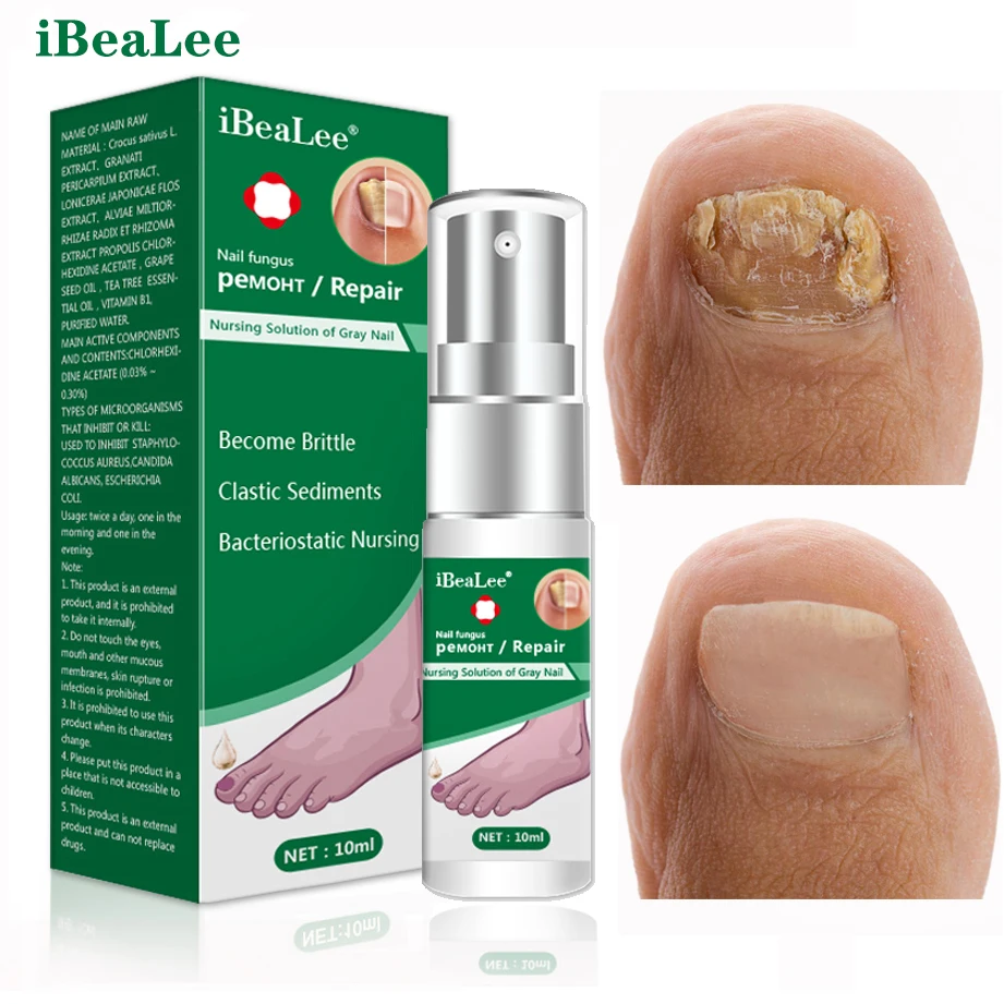 

iBeaLee Nail Fungus Treatment Essence Serum Hand Foot Care Fungal Removal Repair Gel Anti-infective Paronychia Onychomycosis