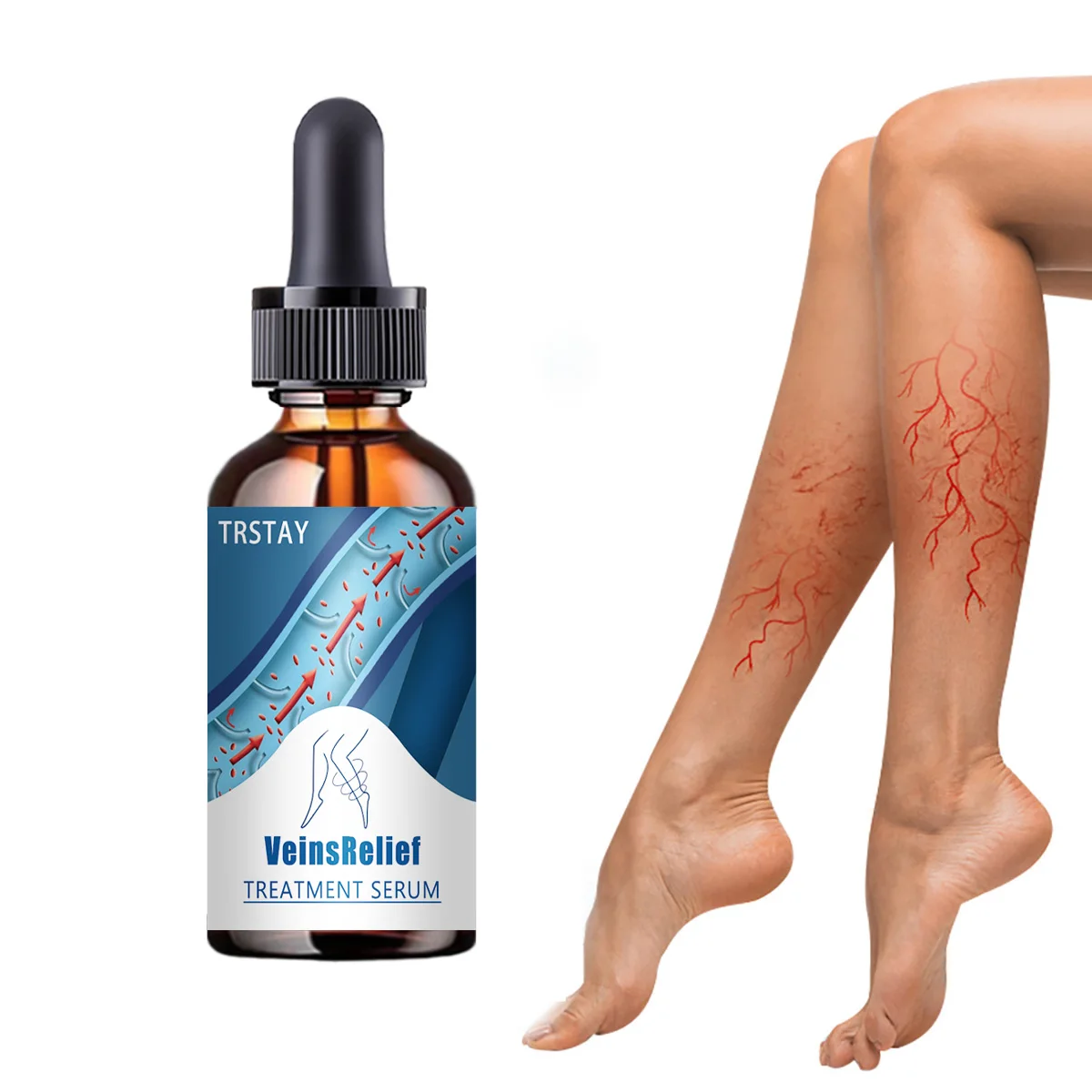 Сыворотка для лечения варикозного расширения вен TRSTAY снимает боль и давление в