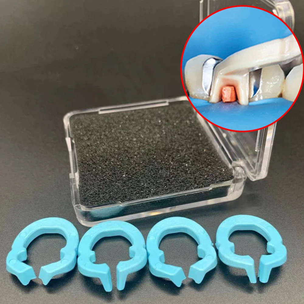 3/5/10 коробок зажимное кольцо из стоматологической смолы эргономичный Резной