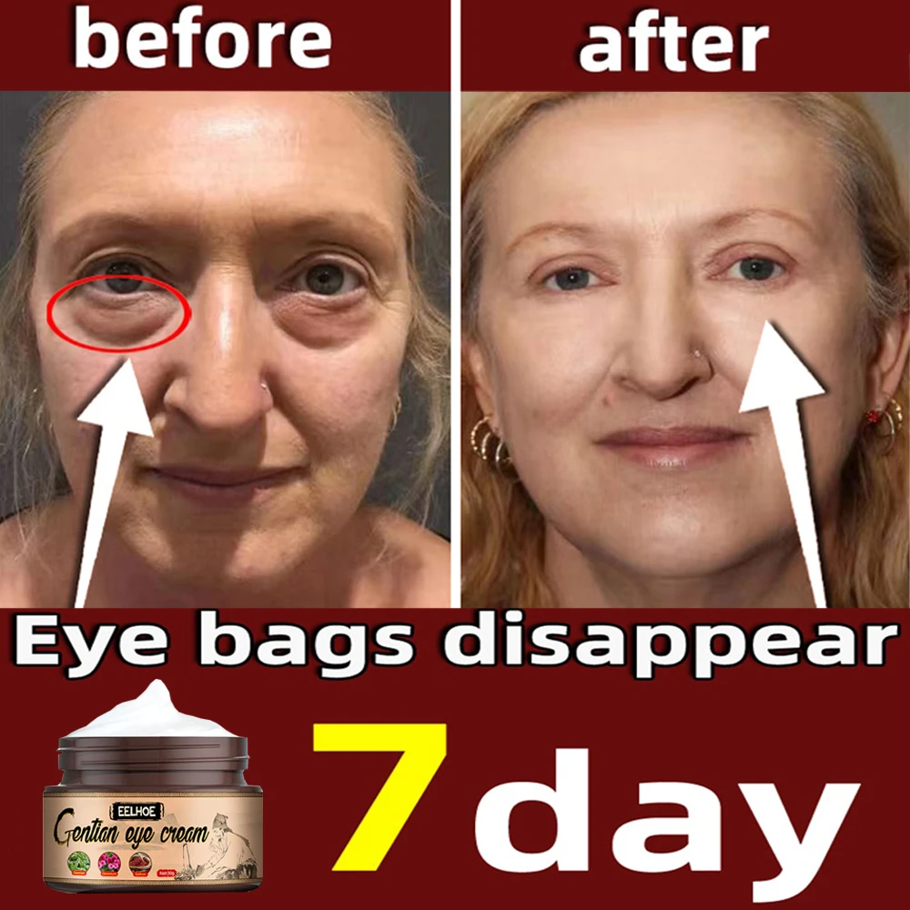 

Anti-Wrinkle Eye Cream Anti-Dark Circles Eye Serum Eye Bags Fatty Grains Removal Anti-Aging Firming Eye Skin Care For Women Men