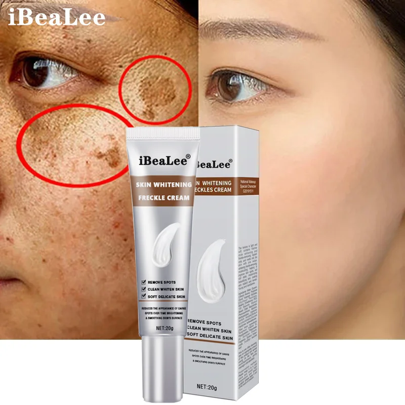 

Effective Whitening Freckles Cream Remove Melasma Dark Spots Fade Melanin Corrector Brighten Moisturizing Face Skin Care Product