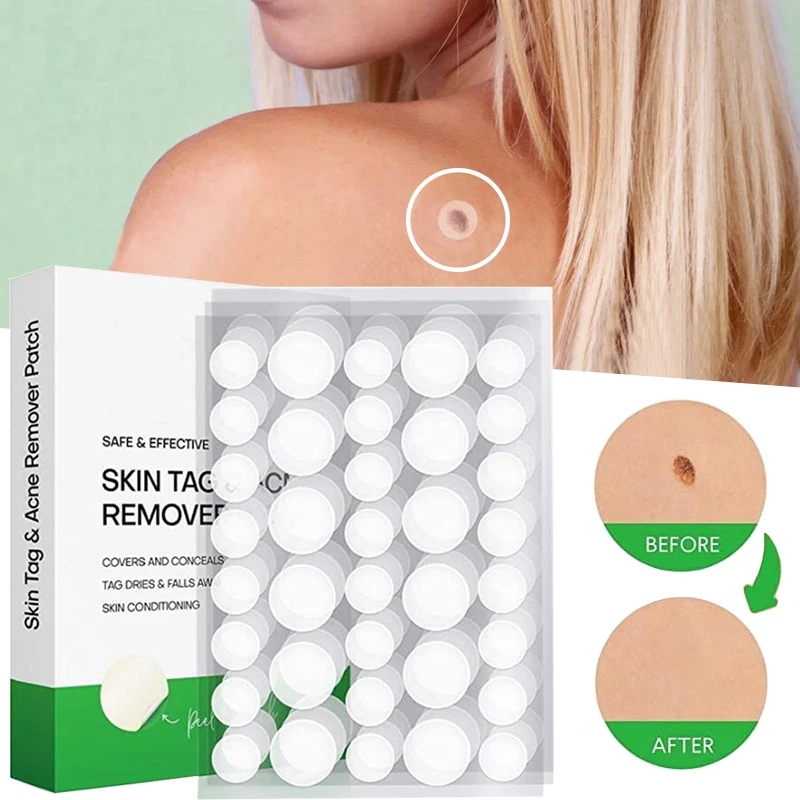 

72PC/Box Acne Remove Skin Tag Body Wart Treatment Sticker Hydrocolloid Gel Invisible Acne Patch Pimple Remover Beauty Tools
