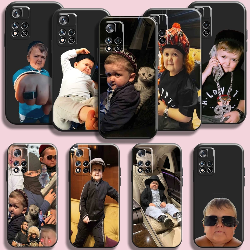 

Funny Hasbulla Child Phone Case For Xiaomi Redmi Note 11 11T 11S 10 10S 9 9S Pro 5G 9A 9T 9C Carcasa Back Black Liquid Silicon