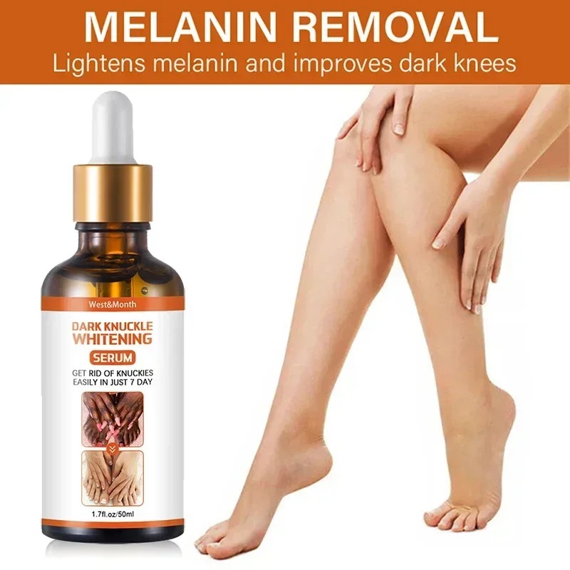 Средство для удаления темных суставов коленей Сыворотка от никотинамид